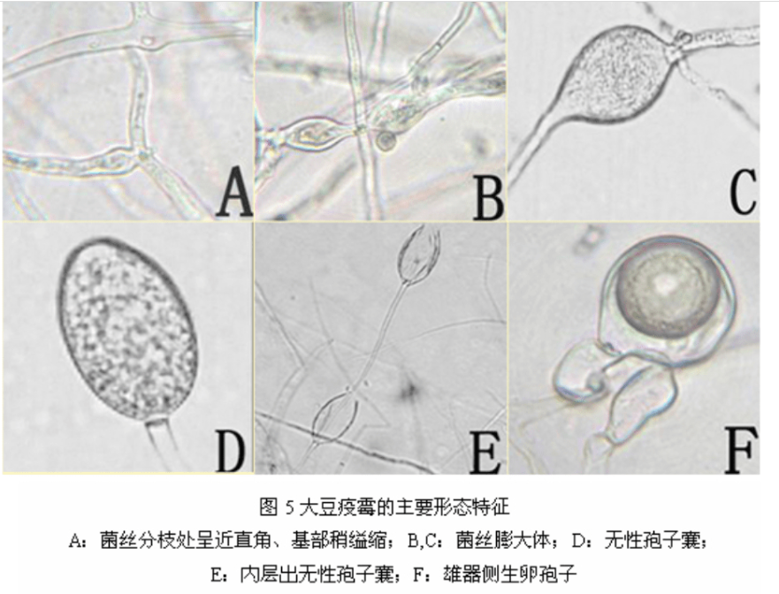 大豆疫霉菌2.png